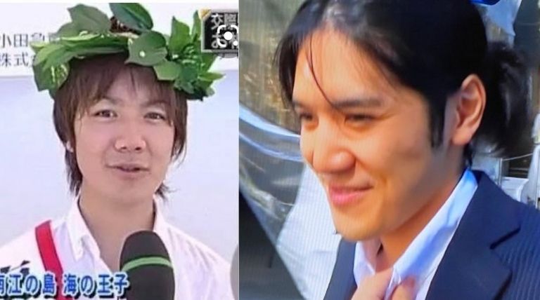 小室圭の整形箇所を総まとめ 9回の手術で費用は250万円以上 Basement Picks