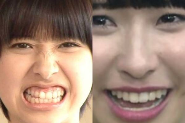 ヒルナンデス 玉井詩織が可愛くなった 目の整形と激痩せで美人顔に Basement Picks ヒルナンデス 玉井詩織が可愛くなった 目の整形と激痩せで美人顔に Basement Picks